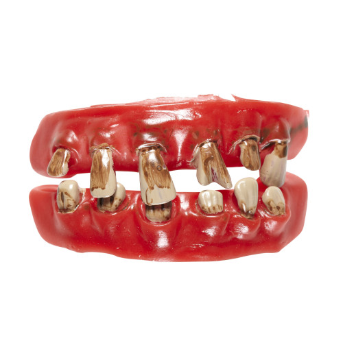 DENTIER DE VIEILLARD