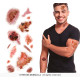 TATOUAGES BLESSURES INFECTEES