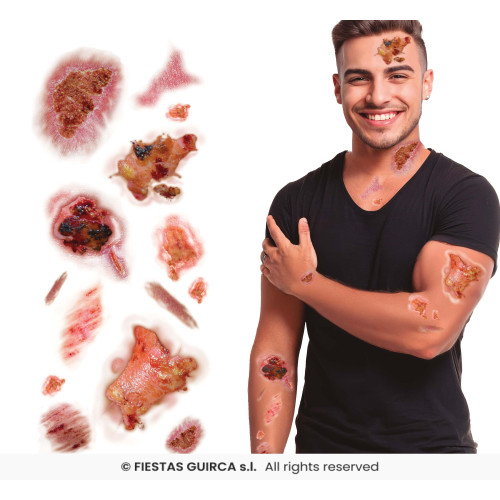TATOUAGES BLESSURES INFECTEES