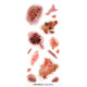 TATOUAGES BLESSURES INFECTEES